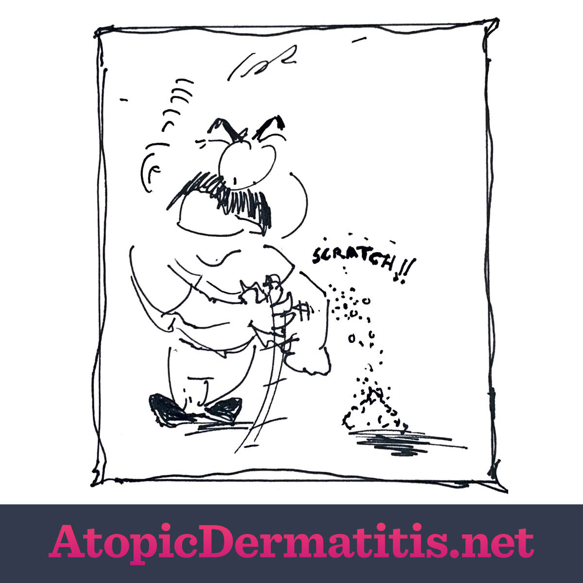 First panel of the comic. A man scratching himself as skin flakes pile up on the ground. Text in the air reads