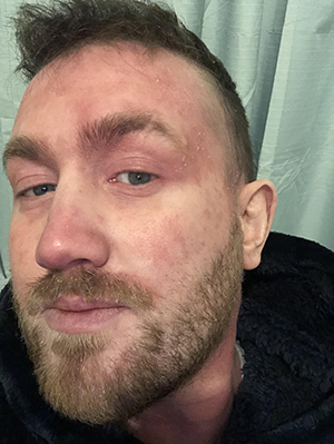 Ryan's experience trying different pharmaceutical treatments