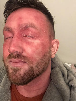 Ryan's experience trying different pharmaceutical treatments